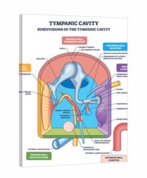 Tympanic cavity diagram showing middle ear anatomy with ossicles-malleus, incus, stapes-summarizing wall subdivisions and sound conduction. Outline diagram