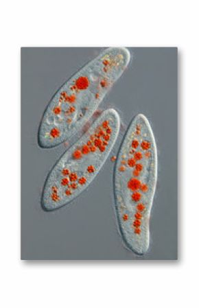 Paramecium caudatum - gefüttert mit gefärbten Hefezellen - DIC