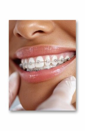 Dentist applying braces to patient's teeth for orthodontic treatment