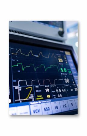 Tracking vital signs in healthcare. Medical equipment displays vital signs, indicating a patient's health status in a clinical environment.