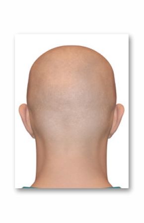 Bald head man. Smooth shaved nape isolated on white background. Alopecia illustration