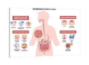 Dysbiosis symptoms visual shows gut imbalance across body, human silhouette with intestines and bacteria icons highlights digestive, skin, mental signs. Outline diagram