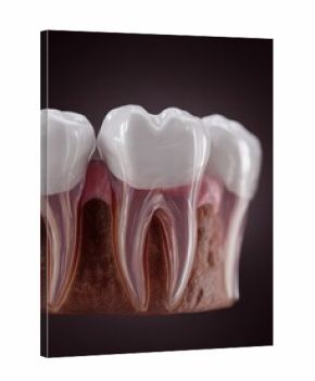 realistic 3D anatomy of mouth showing tooth and gum infection