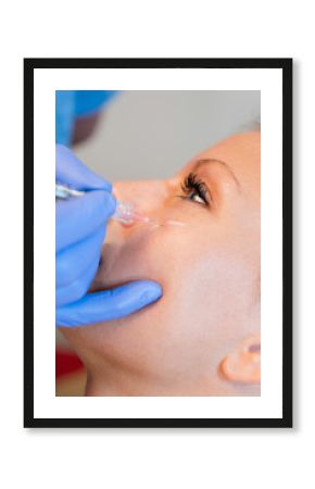 Hyaluronic acid filler