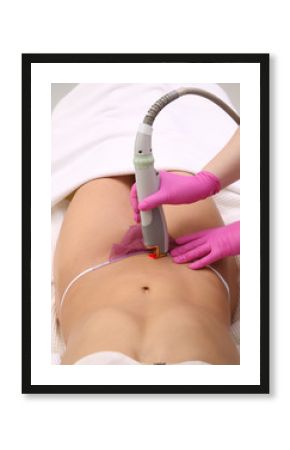 Laser hair removal.