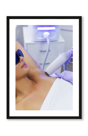 Epilation wiith diod laser