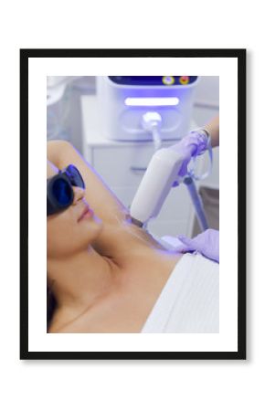 Epilation wiith diod laser