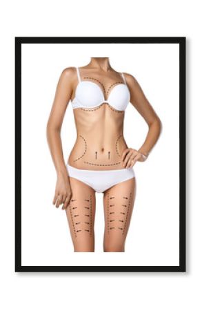 Woman torso in underwear with medical marks for plastic surgery or liposuction