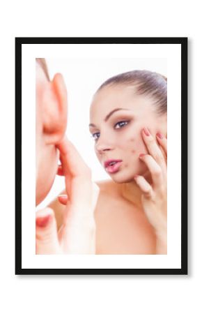 Acne in women