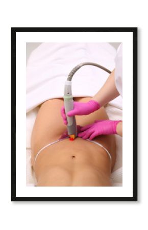Laser hair removal.