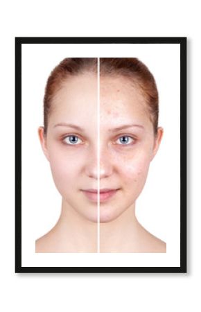 Befor and after treatment. Beautiful woman's portrait isolated on white background, before and after retouch, skin care.