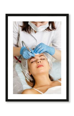 Dermabrasion girl's forehead. Machine cosmetology. Spa. Facial Rejuvenation. Mechanical peeling skin.