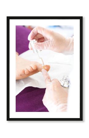 Olejek do pielęgnacji skórek, piękne stopy.  Zdrowa stopa, kosmetyczka aplikuje preparat pielęgnacyjny  