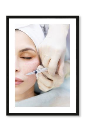 Top view of Closeup portrait of female face with closed eyes getting Biorevitalization