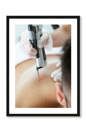 The beautician's hands removing back hair with a laser to her client in the beauty salon.