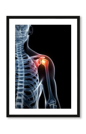 3d rendered illustration - painful shoulder