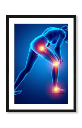 Female Leg joint pain