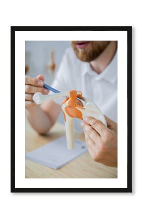 Doctor showing flexible knee joint model to his patient and explains the cause of his pain in medical office. Patient visiting physiotherapist in clinic. Surgery, healthcare and medicine concept.