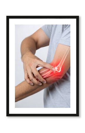 Elbow Pain Illustration with X-Ray Highlighting Tendonitis – Medical Concept Image for Injury and Joint Issues