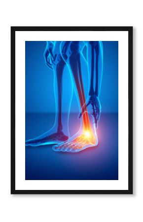 Male foot with ankle pain