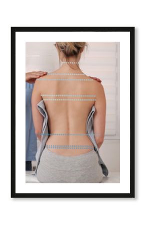 Scoliosis Spine Curve Anatomy, Posture Correction. Chiropractic treatment, Back pain relief.