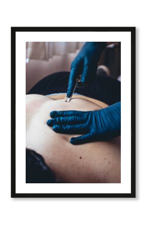 Vertical shot of a masseur with gloves using a physio hook on the back of a man