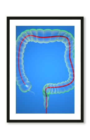 Colonscopia esame colon apparato digerente