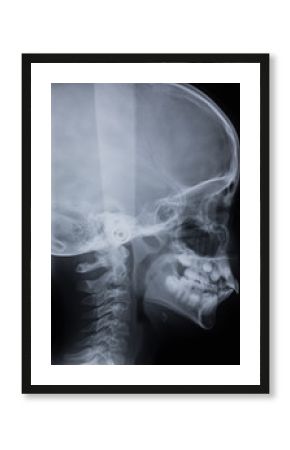 La bambina ai raggi x