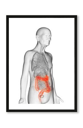 3d rendered anatomy illustration of an elderly mans colon