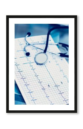 stethoscope and electrocardiogram on the table from the therapi